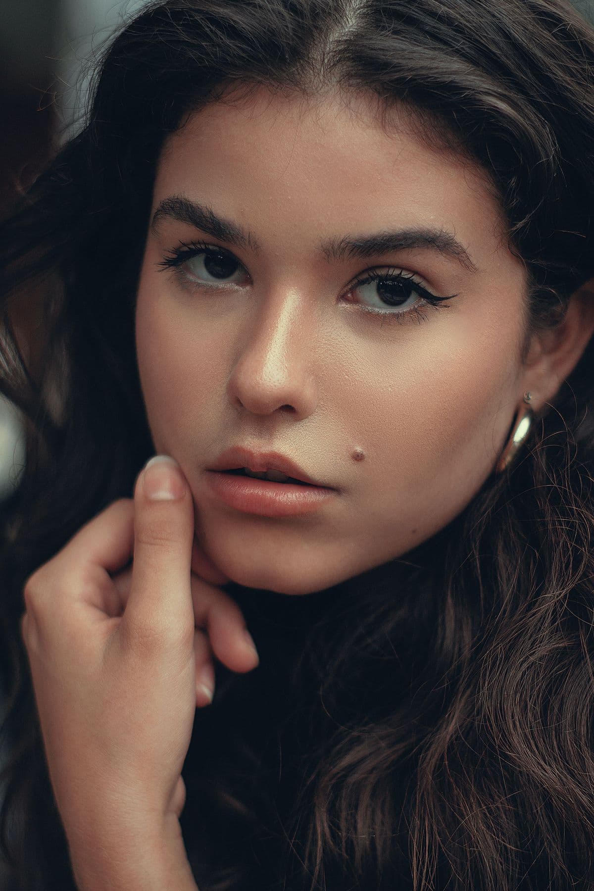 Fat Grafting Versus a Cheek (Midface) Lift: Which Procedure is the Most Appropriate for Me?